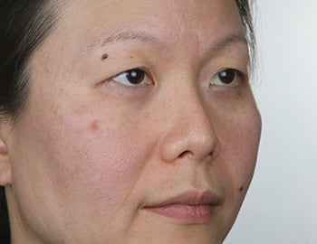 Model with Combination Skin