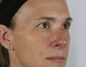 Model with Mature Skin Type